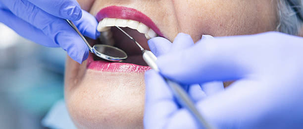 Best Emergency Dentist for Lost Fillings or Crowns in Alamo, TX